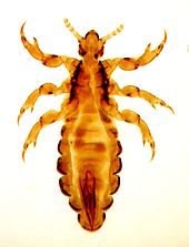 170px-Fig._1._Male_of_head_louse